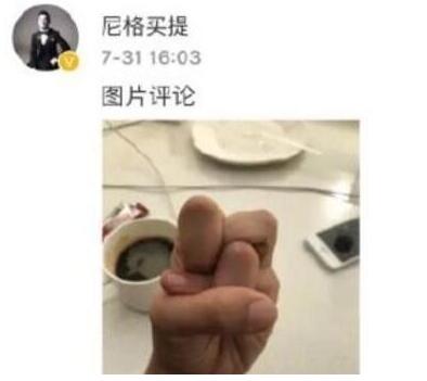一般人做不出的張一山秋水誓？醫(yī)生：這是??！