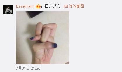 一般人做不出的張一山秋水誓？醫(yī)生：這是??！